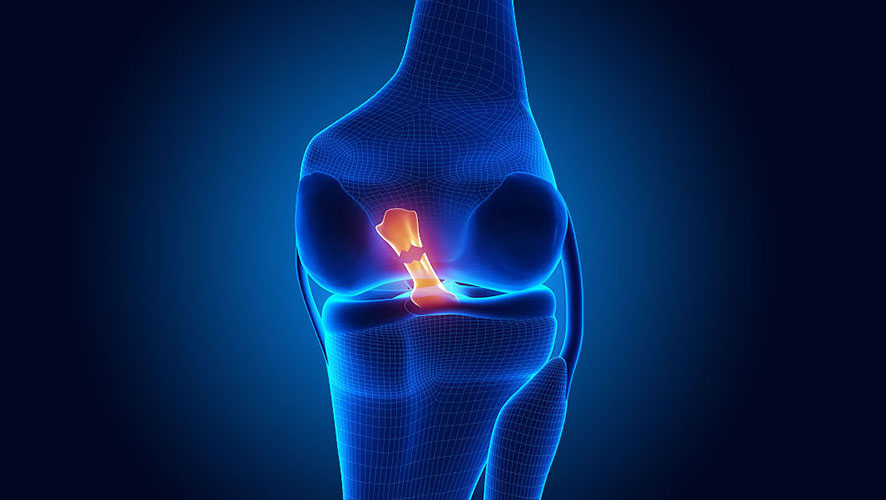 Prednji križni ligament (ACL)